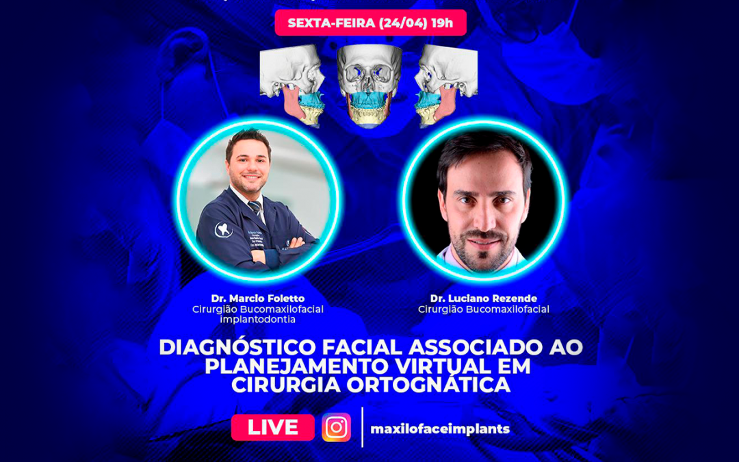Dr. Luciano e Dr. Marcio Foletto – Diagnóstico Facial Associado ao Planejamento Virtual em Cirurgia Ortognática (LIVE)